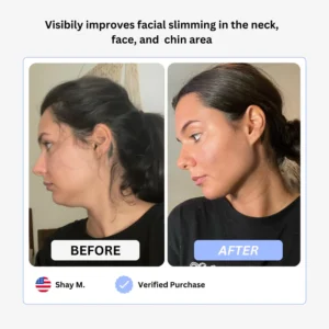 True Beauty Glow Device - Image 8