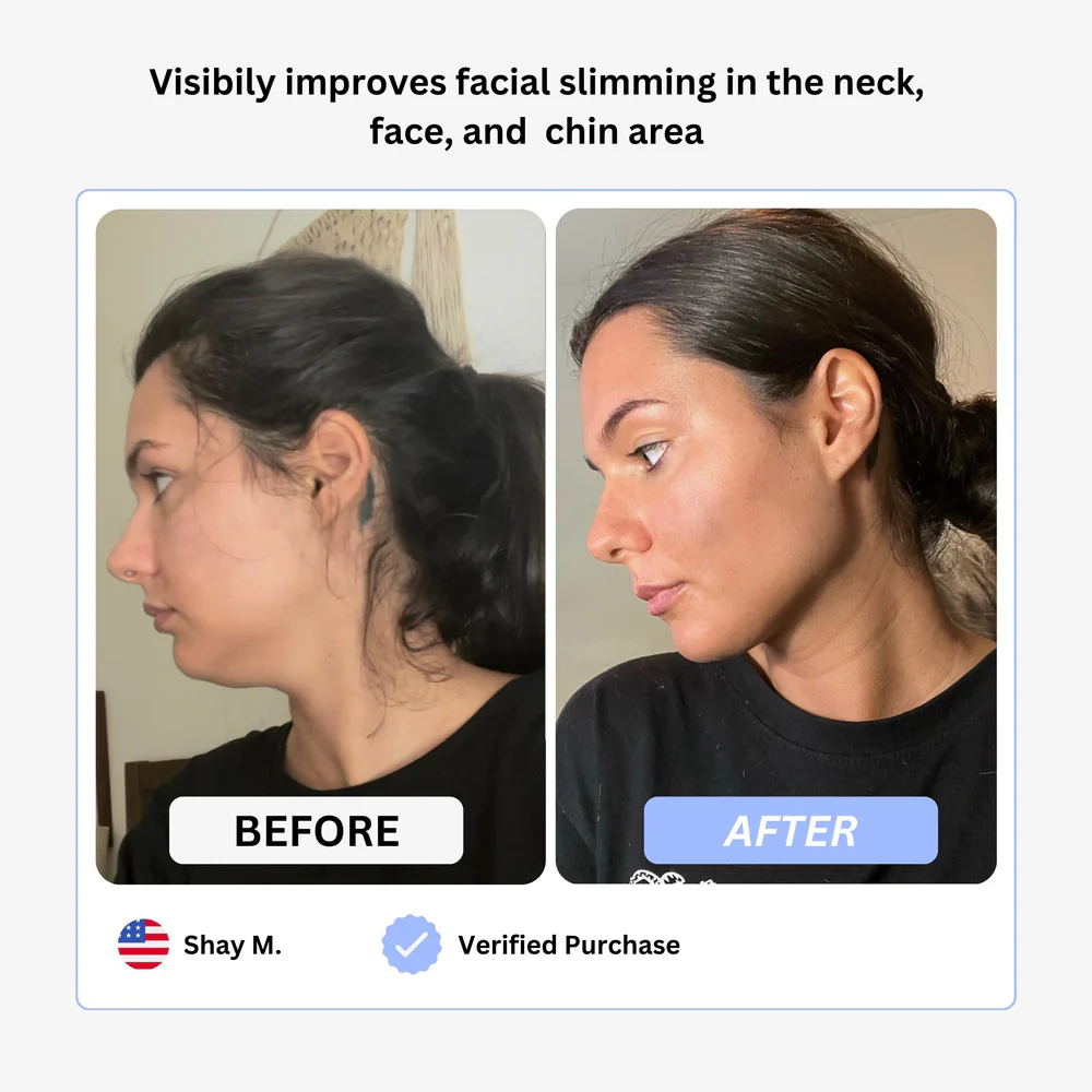 True Beauty Glow Device - Image 8