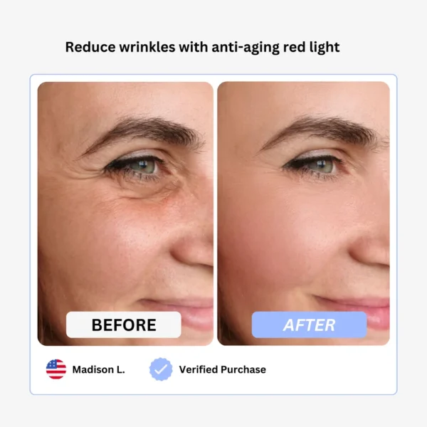 True Beauty Glow Device