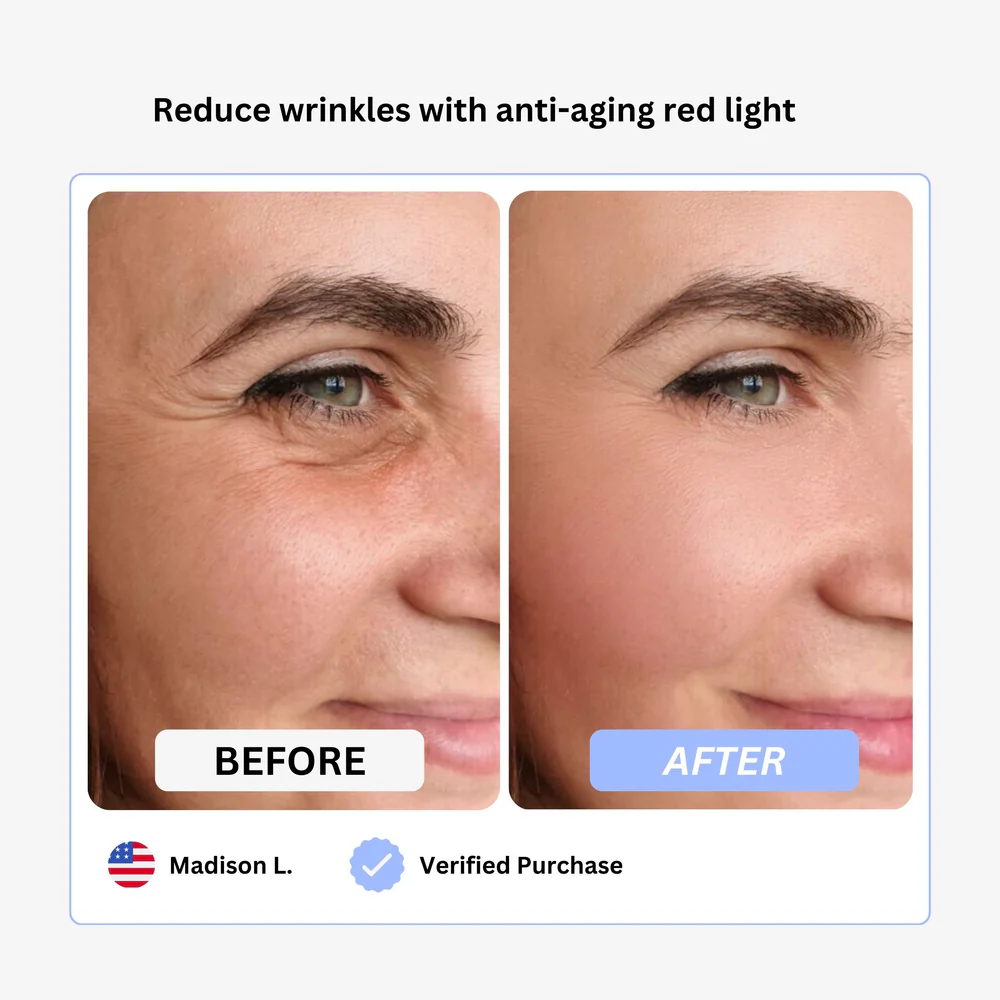 True Beauty Glow Device - Image 7