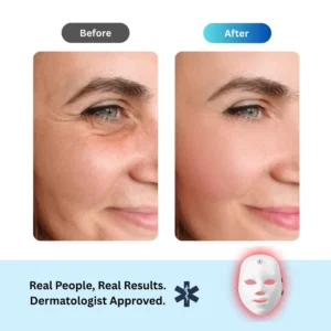 Anti-Aging Red Light Mask - Image 4
