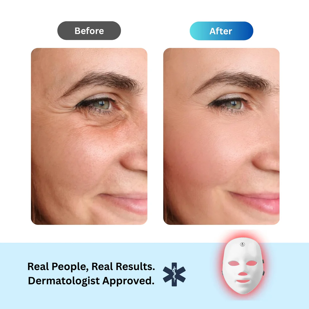 Anti-Aging Red Light Mask - Image 4