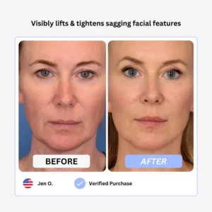 True Beauty Glow Device - Image 6