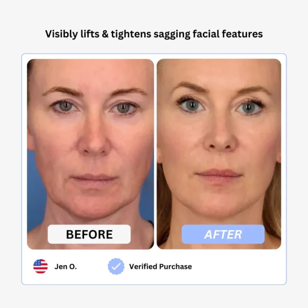 True Beauty Glow Device