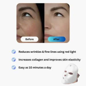 Anti-Aging Red Light Mask - Image 2